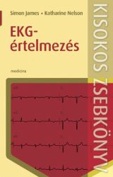 EKG-értelmezés