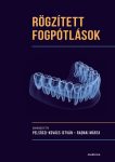 Rögzített fogpótlások