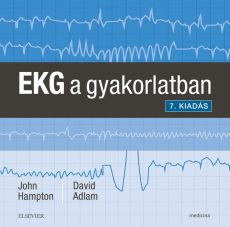 EKG a gyakorlatban