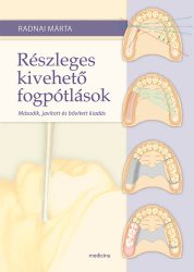 Részleges kivehető fogpótlások 2. kiadás