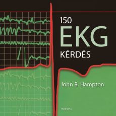 150 EKG kérdés (javított kiadás)
