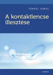 A kontaktlencse illesztése